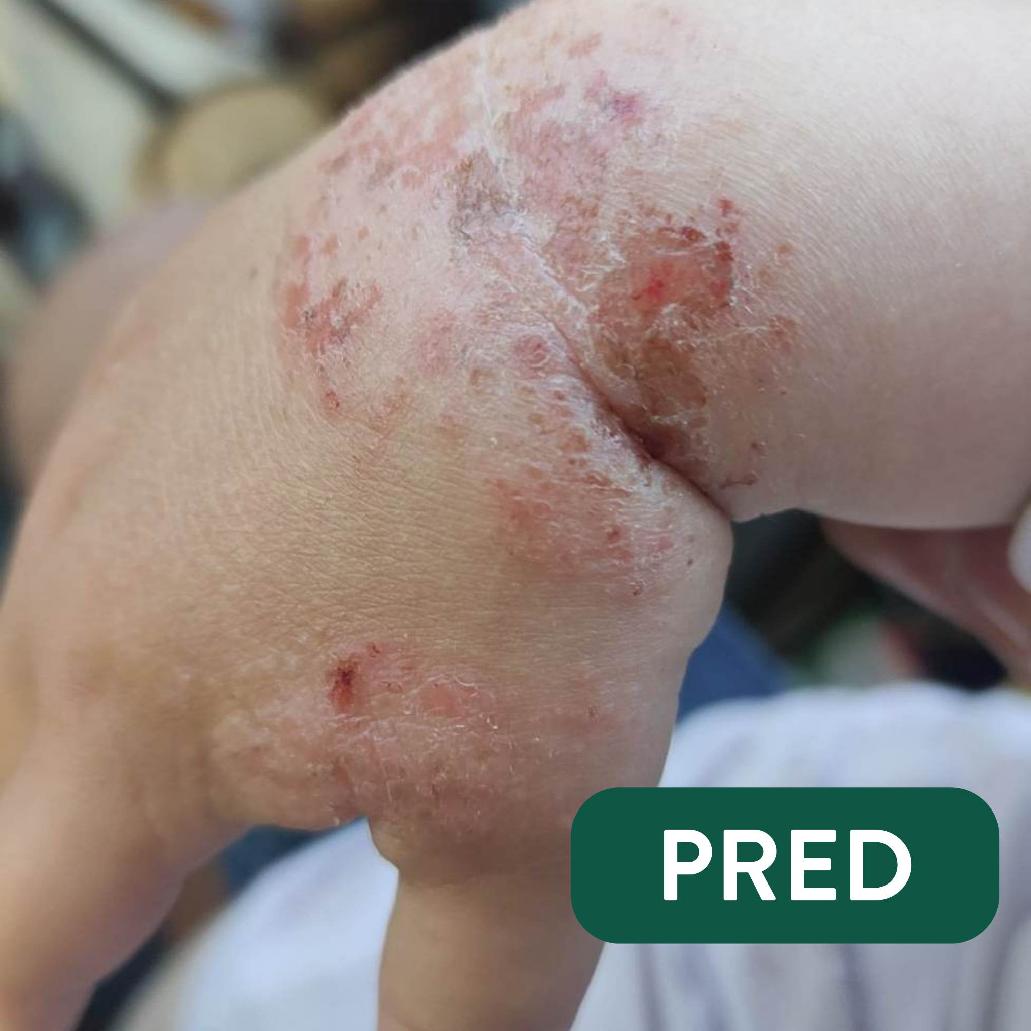 Exem a peoidne bahno pred